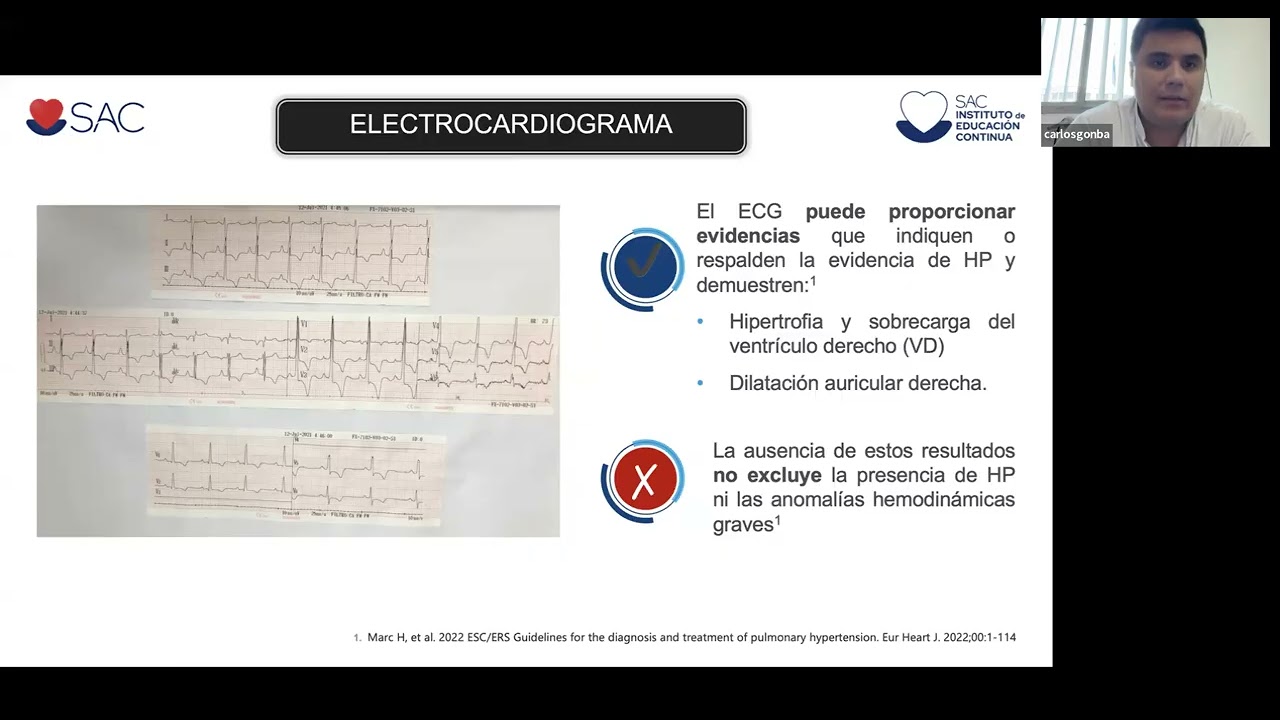Hipertensión pulmonar. Parte I
