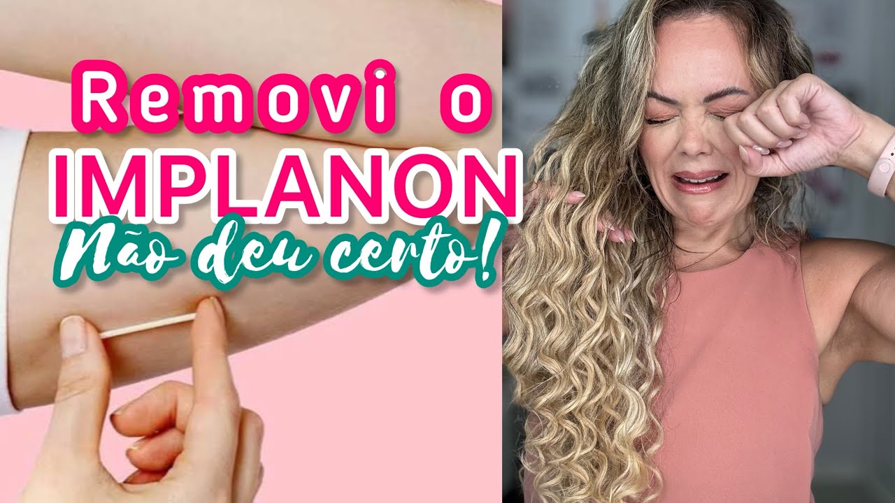 MAQUIA E FALA - TCHAU IMPLANON!