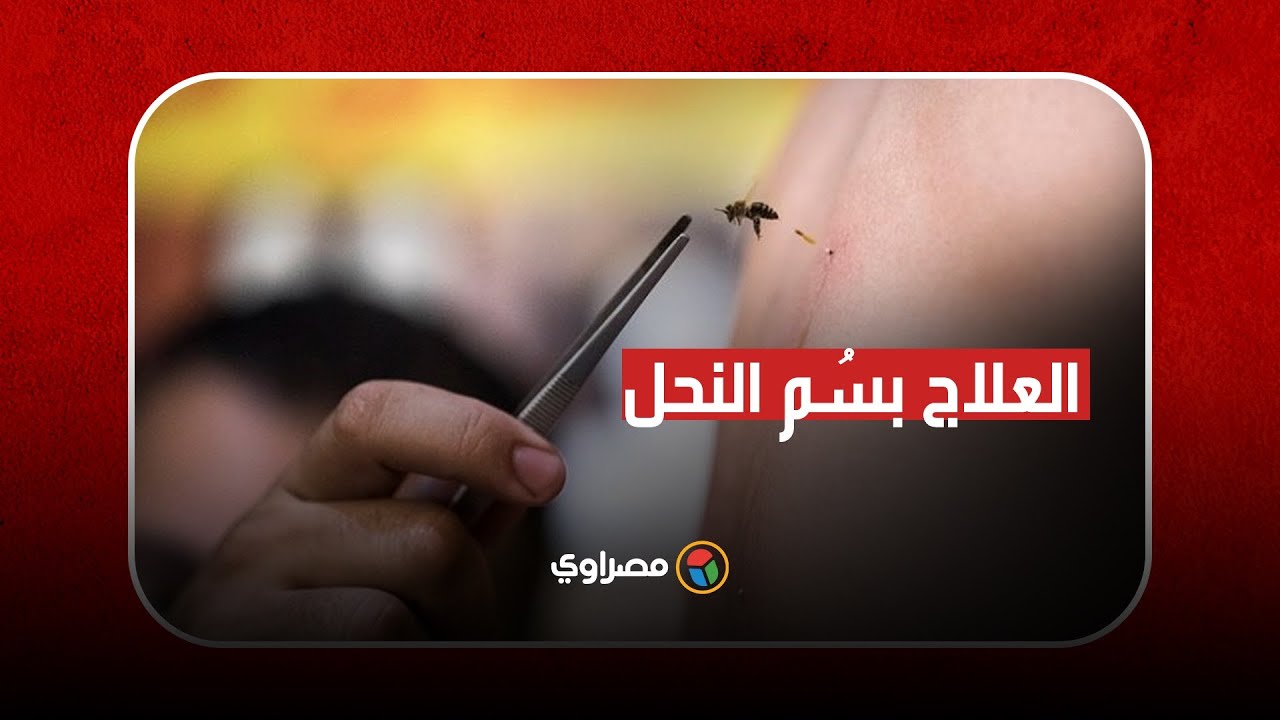 العلاج بسُم النحل في مصر