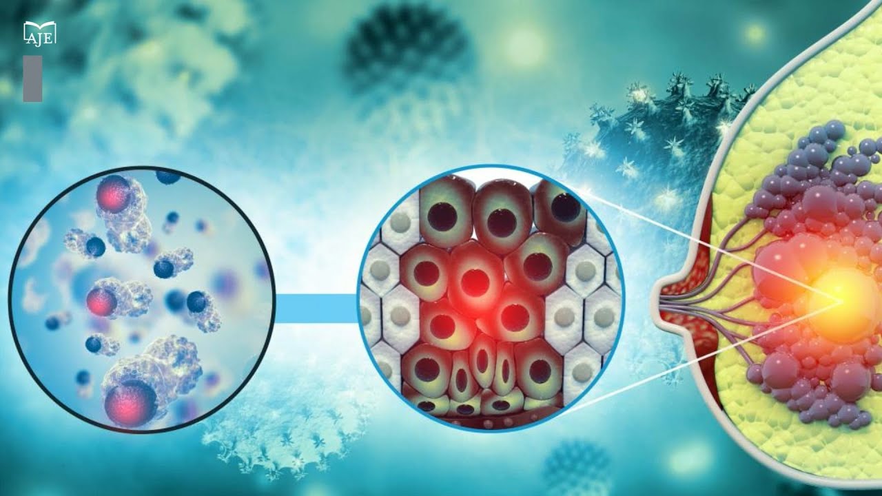 Потеря белка P53 приводит к распространению рака молочной железы в мозг из-за зависимости от жирн...
