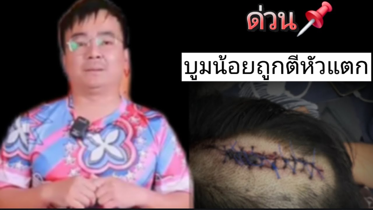บูมน้อยโดนตีหัว..(หายไวๆนะครับ)