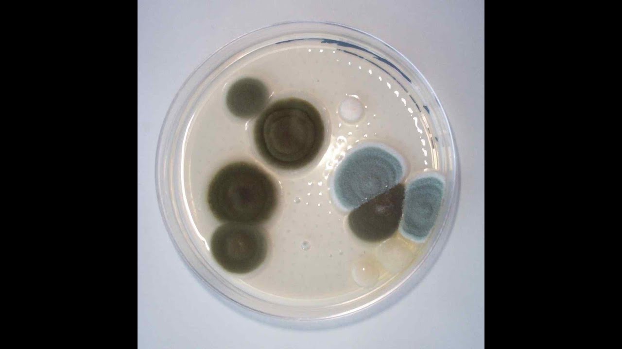 Mold testing: Move out or stay?
