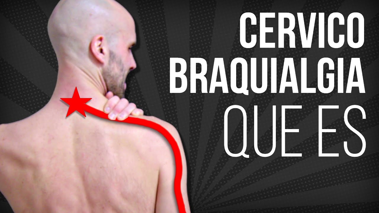⚡CERVICOBRAQUIALGIA, que es, por que se produce, y cual es su TRATAMIENTO