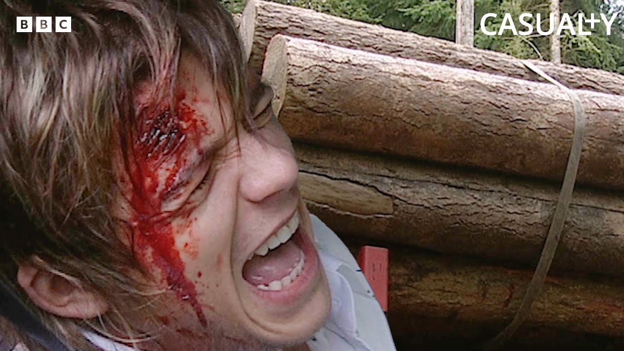 Unsecured Logs Lead to Deadly Lorry Accident... | Casualty