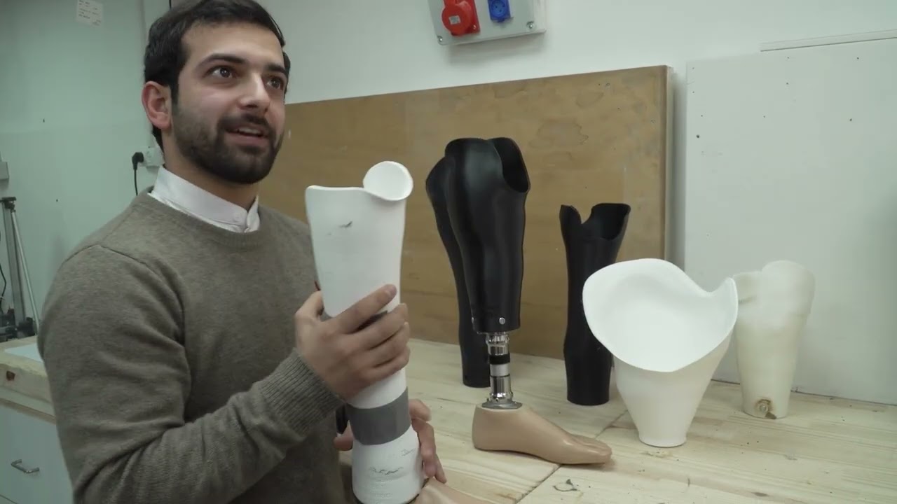 Prosthetics for West Bank Children