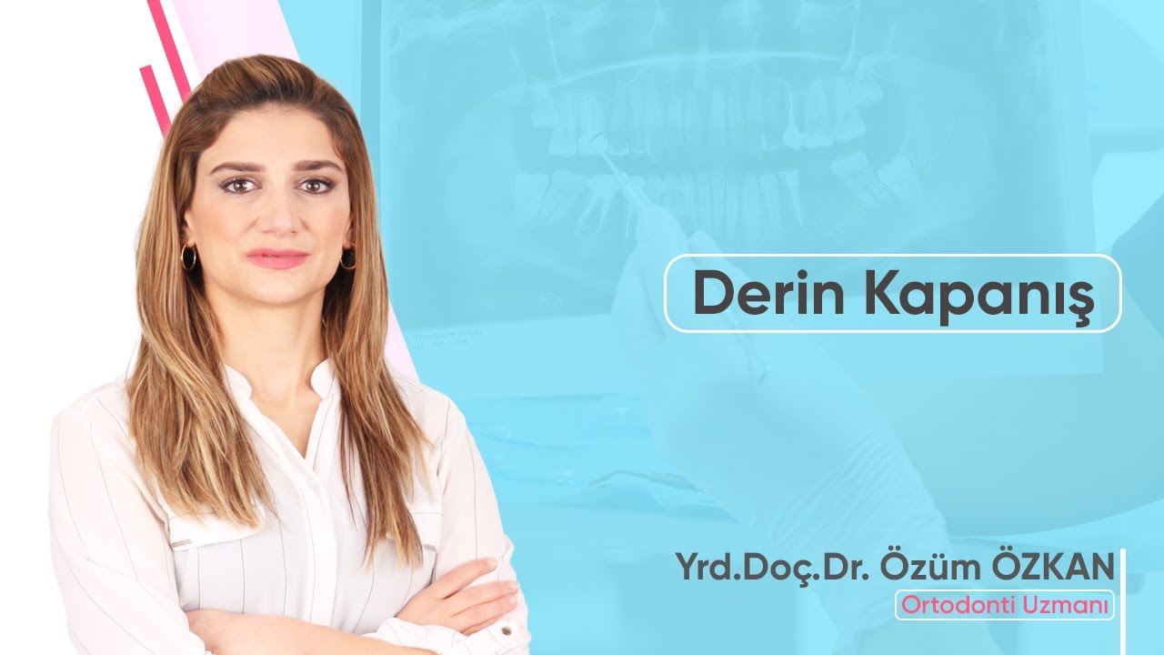 Derin Kapanış Tedavisi | Örtülü Kapanış (Deep Bite)