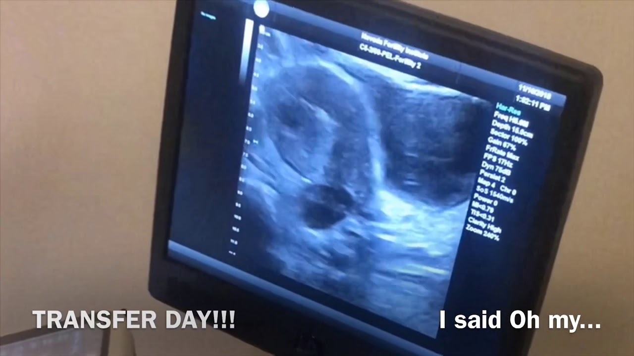Announcing our baby’s name !