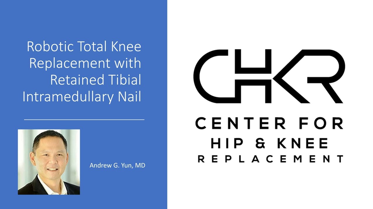 Total Knee Arthroplasty with Retained Tibial Intramedullary Nail