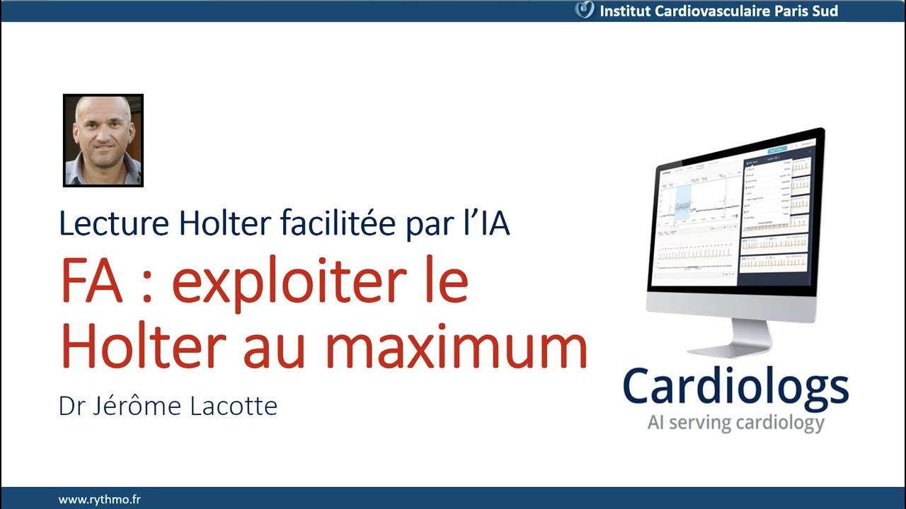 Lecture Holter facilitée par l'IA: Exploiter le Holter au maximum