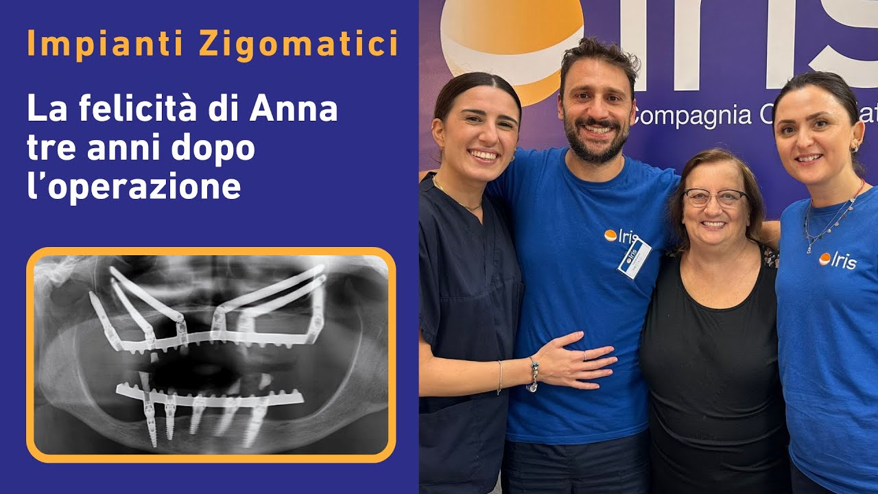 Impianti Zigomatici: La Felicità di Anna Tre Anni Dopo l'Operazione