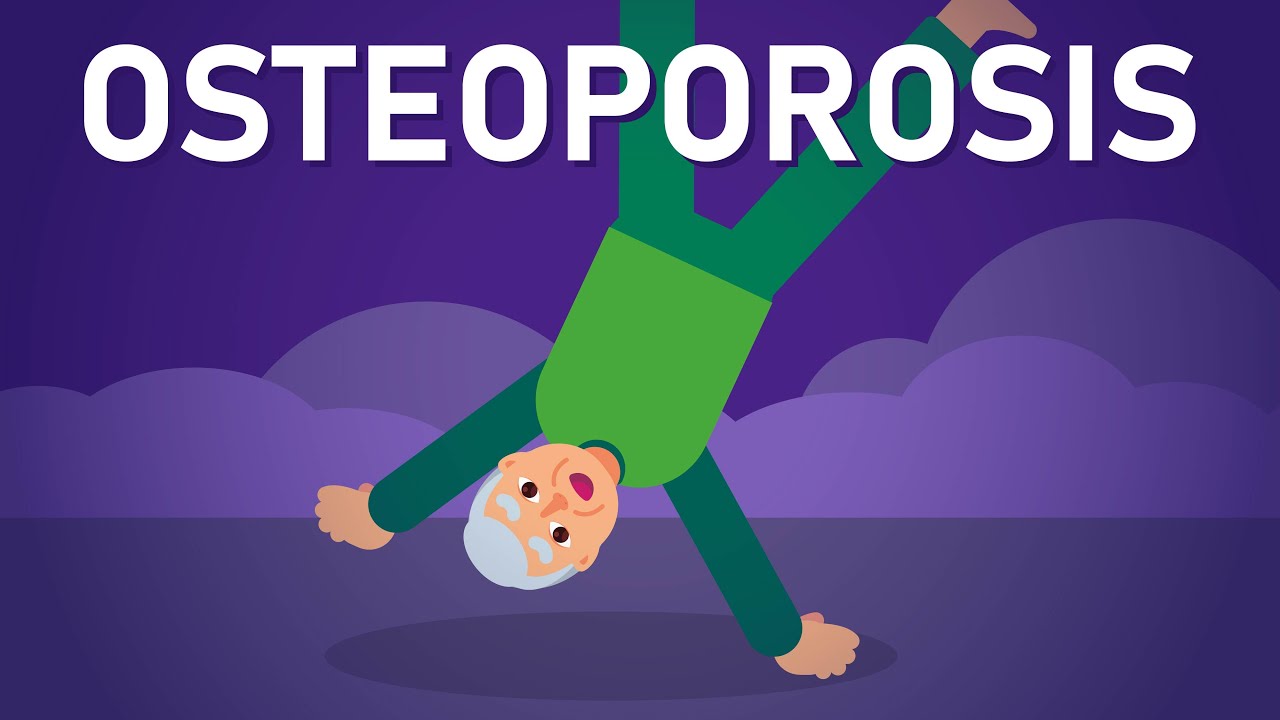 Остеопороз: тихий вор здоровья костей