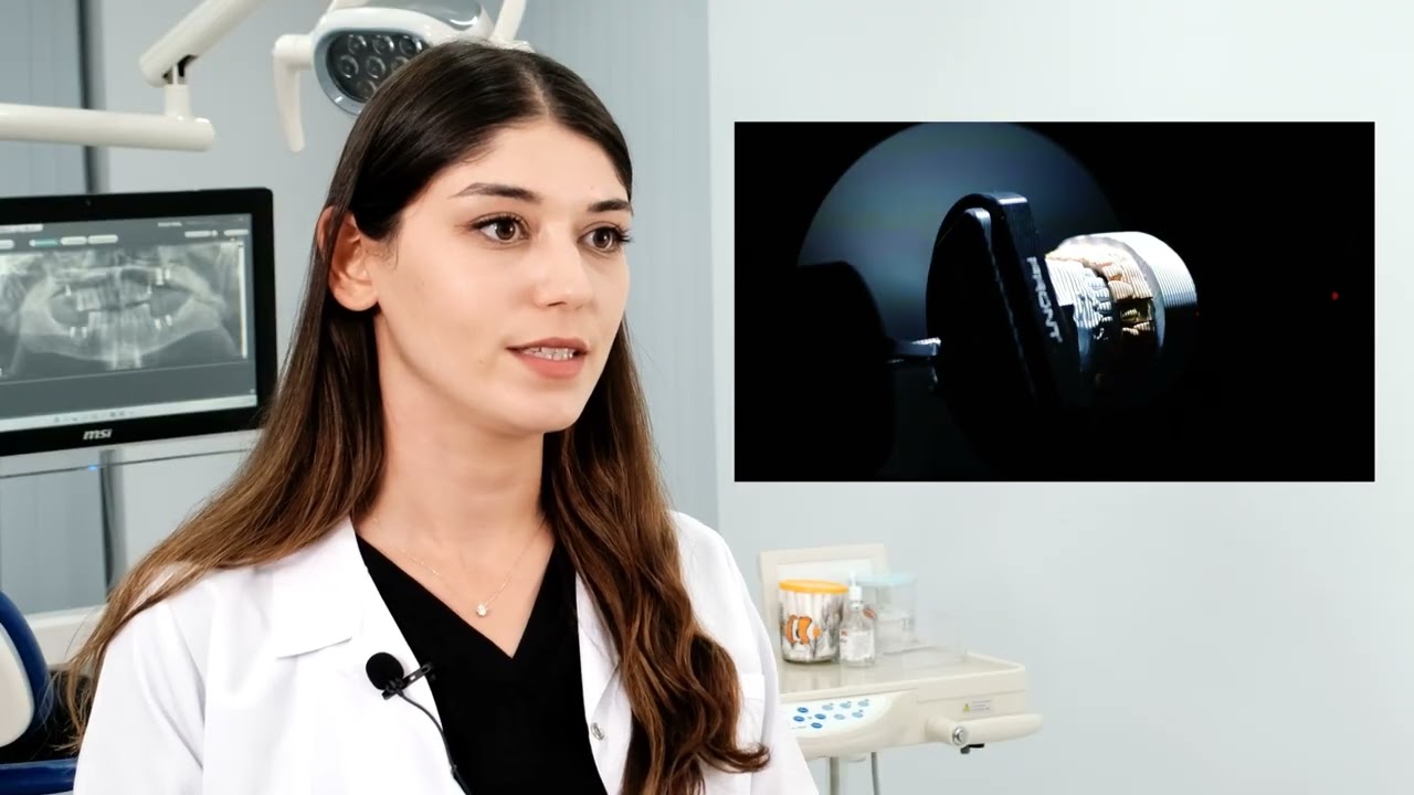 ZIRCONIA CROWNS
