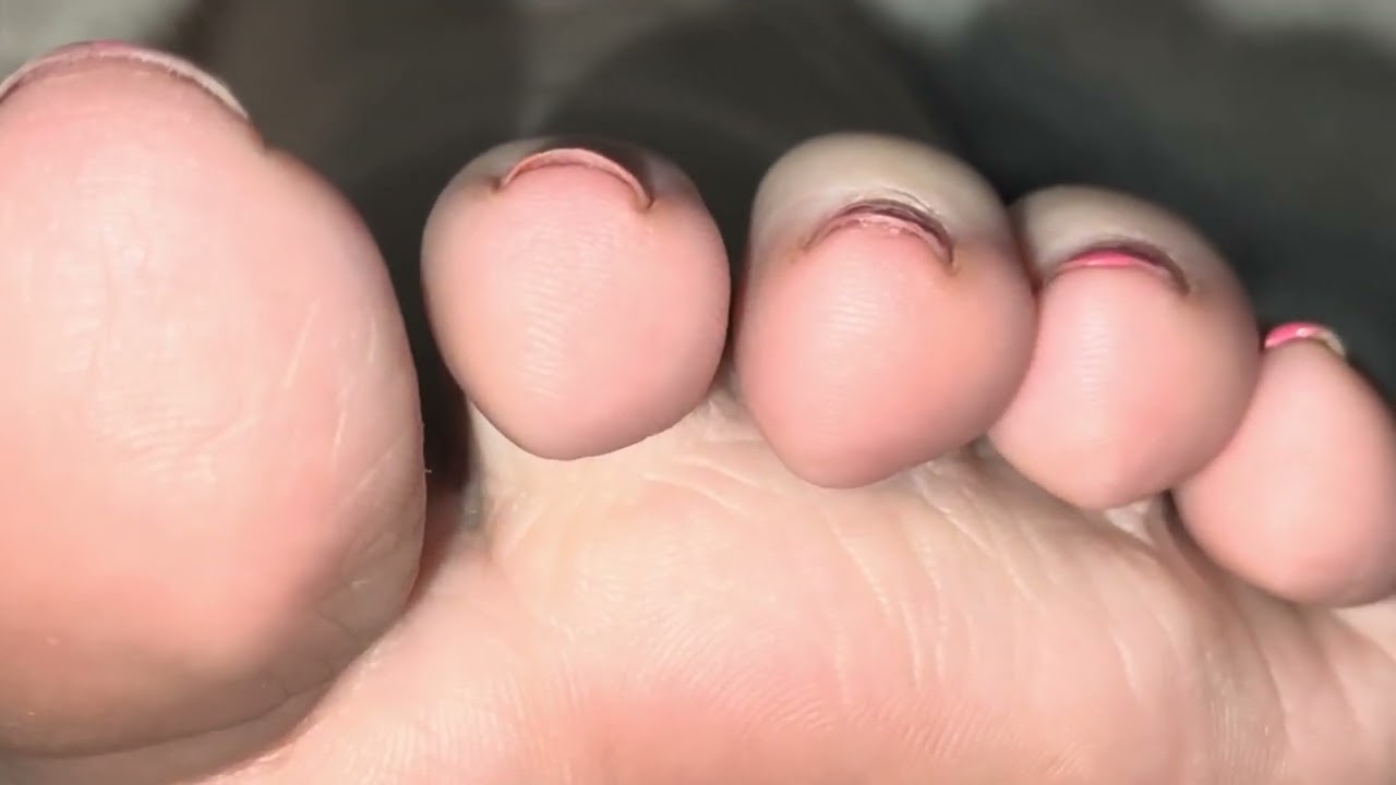 More of my toes closeup, still need some TLC adding some fresh paint to them later 💞