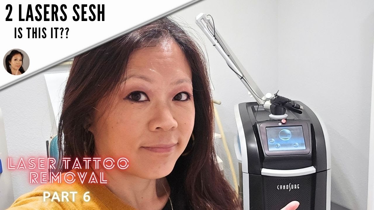 4th Microblading laser removal session: Using 2 lasers-Part 6