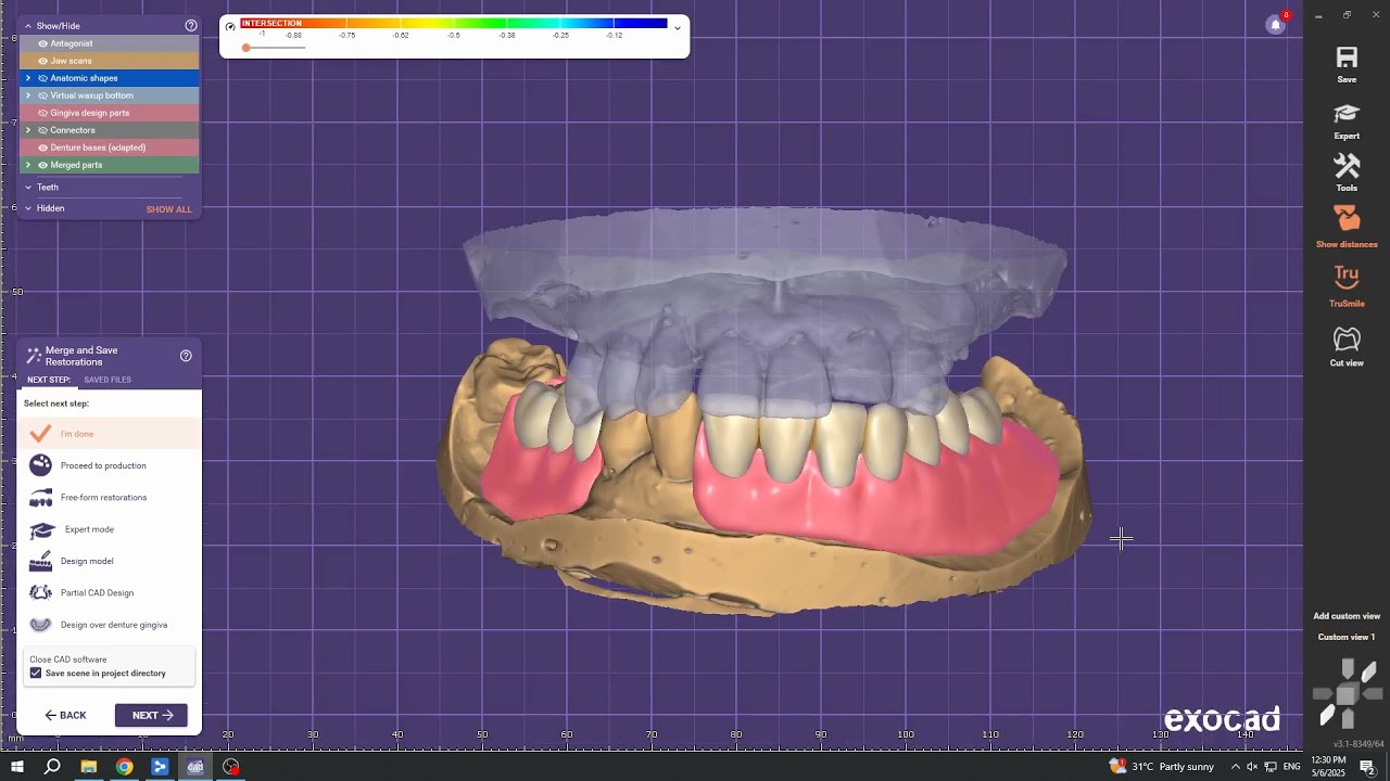 Exocad Acrylic Denture Design For Lower Arch (10 Teeth)