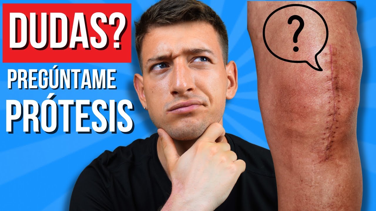 🔴 PRÓTESIS DE RODILLA: Respondo Tus DUDAS Sobre la Recuperación y Ejercicios
