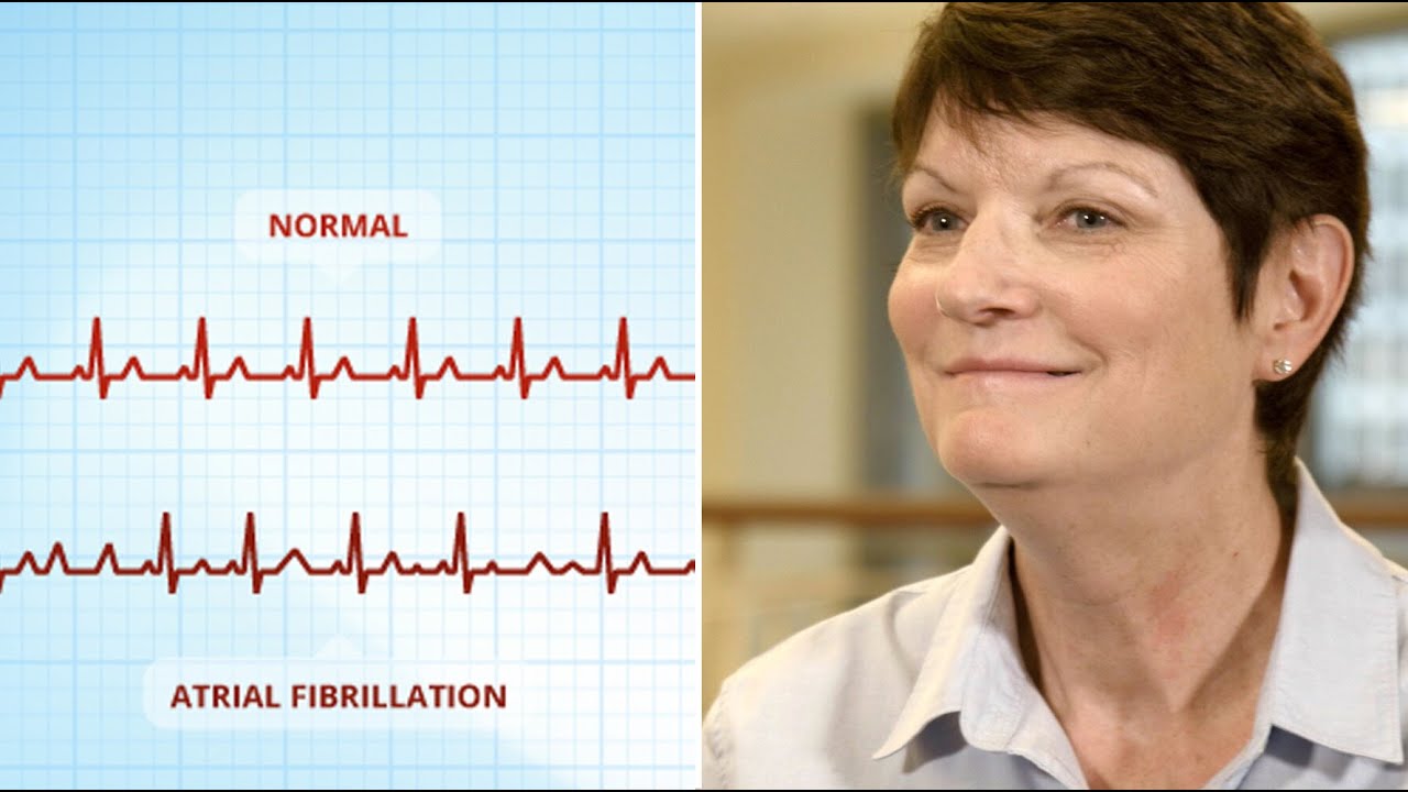 TT Maze Procedure for Atrial Fibrillation: Liz's Patient Success Story