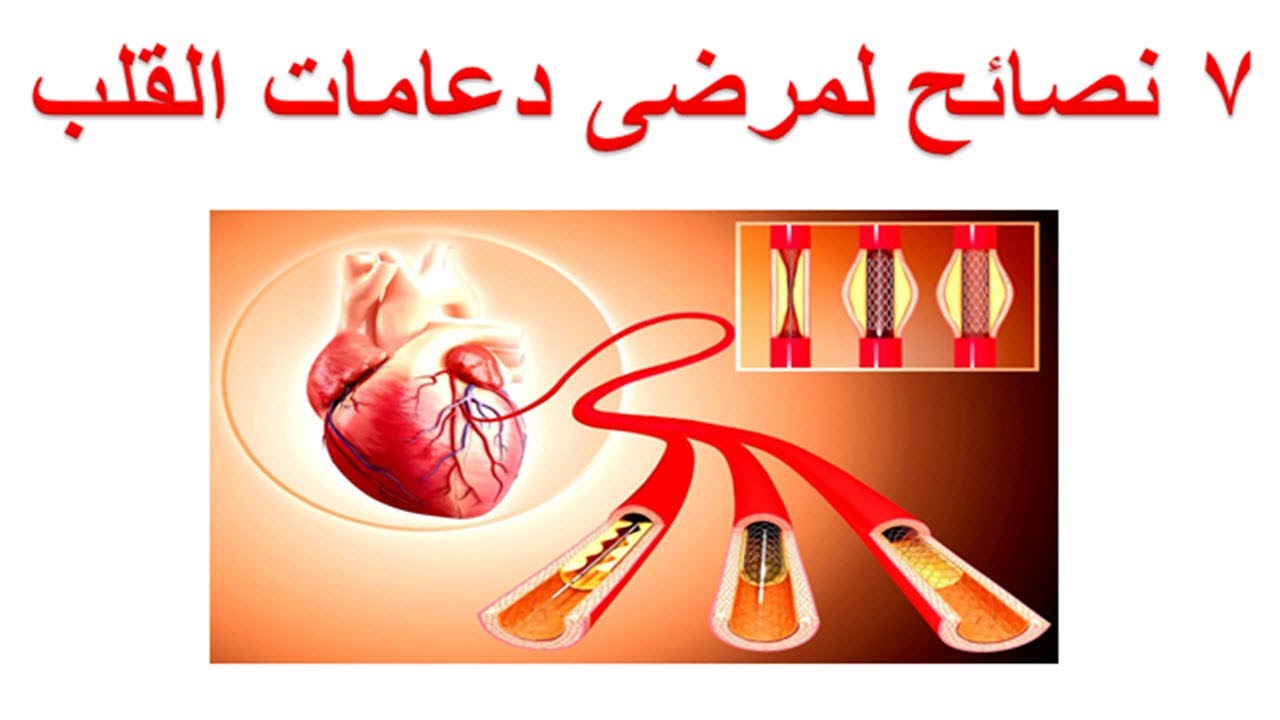 ٧ نصائح هامة لمرضى دعامات القلب - محاذير للمرضى الذين قاموا بتركيب دعامة القلب