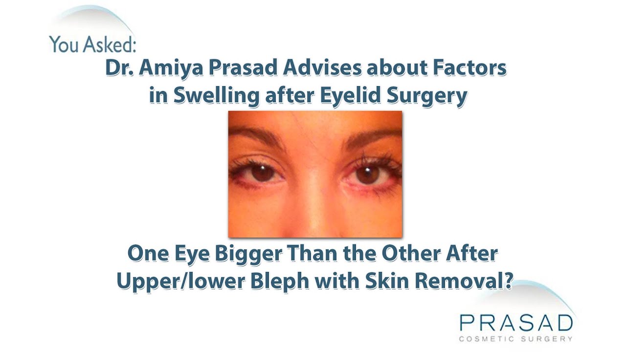 Factors in the Healing Process that Cause Temporary Swelling after Eyelid Surgery