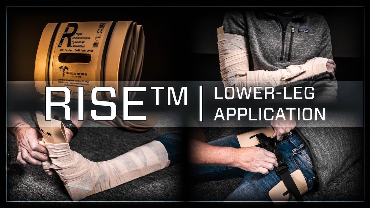 RISE™ (Rigid Immobilization System for Extremities): Lower Leg Application