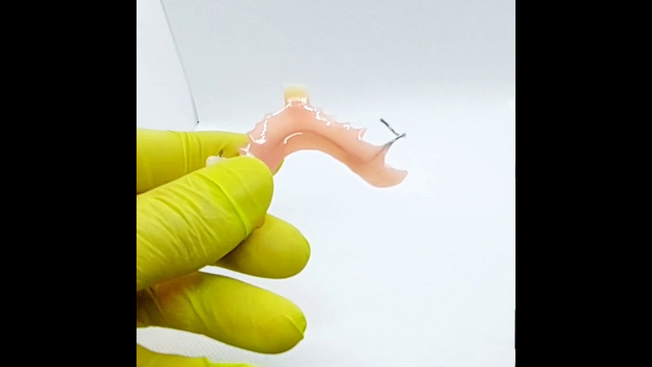 All Acrylic Partial Denture (Dental Lab Direct) &mdash; Up Close
