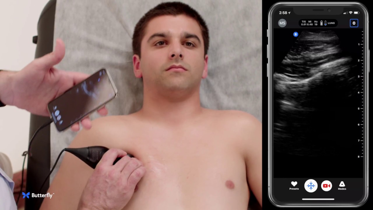 Ultrasound Education: Evaluation for Pneumothorax