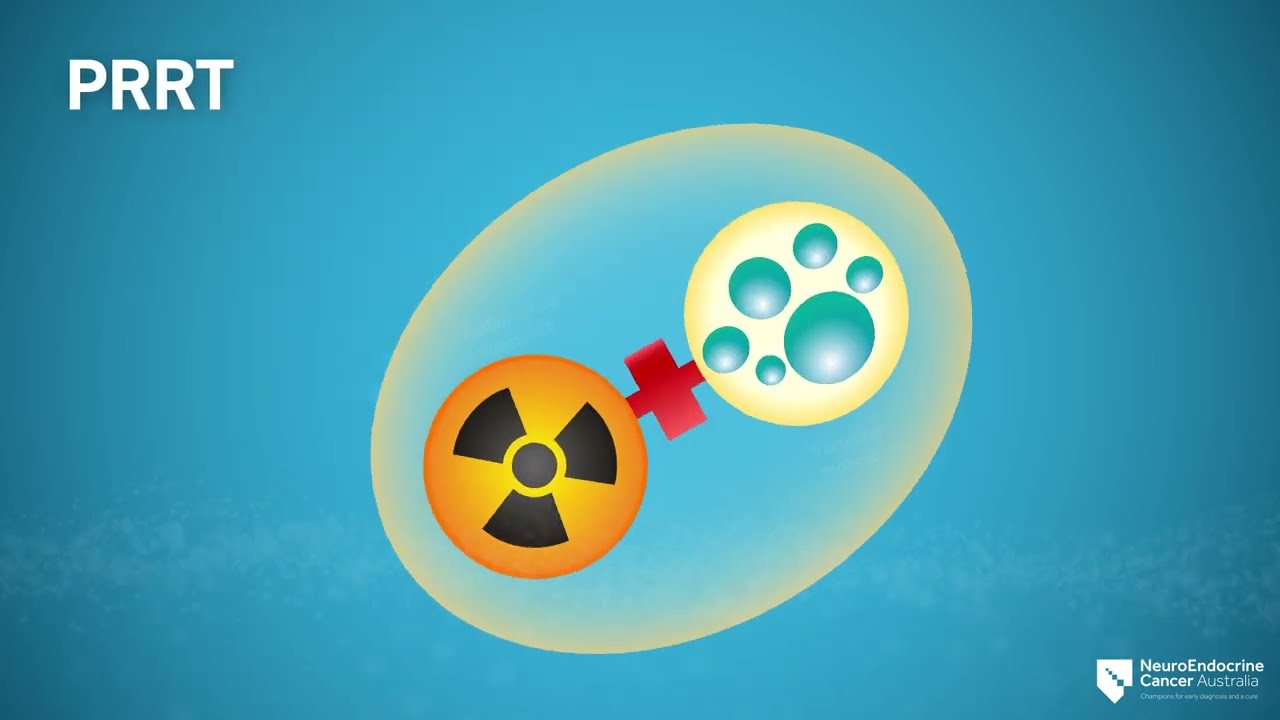 Peptide receptor radionuclide therapy (PRRT) Explainer V2