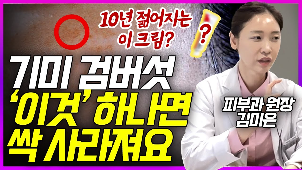 집에서 저렴하게 기미,검버섯 없애는 법 | 피부과 원장이 다 알려드립니다 (김미은 피부과원장 1부)
