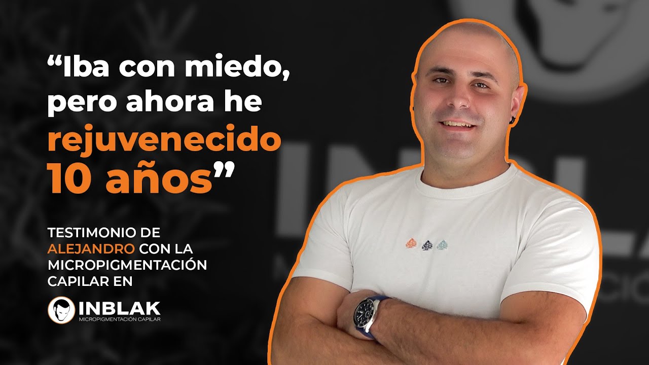 Alejandro: Testimonio de micropigmentación capilar en INBLAK
