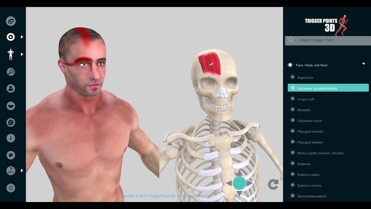 Trigger Point of the Week Occipitofrontalis