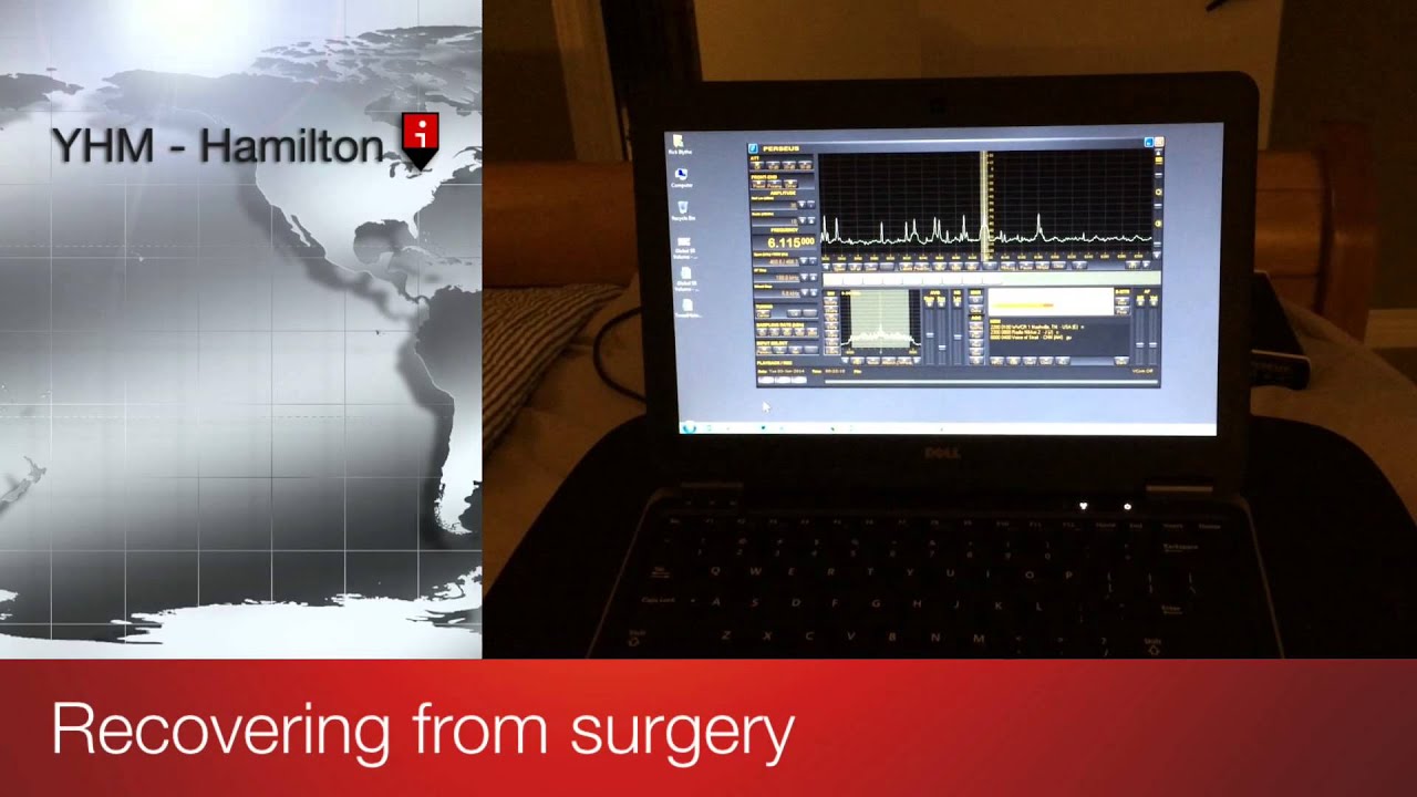 Radio-Hobbyist Recovering from brain surgery