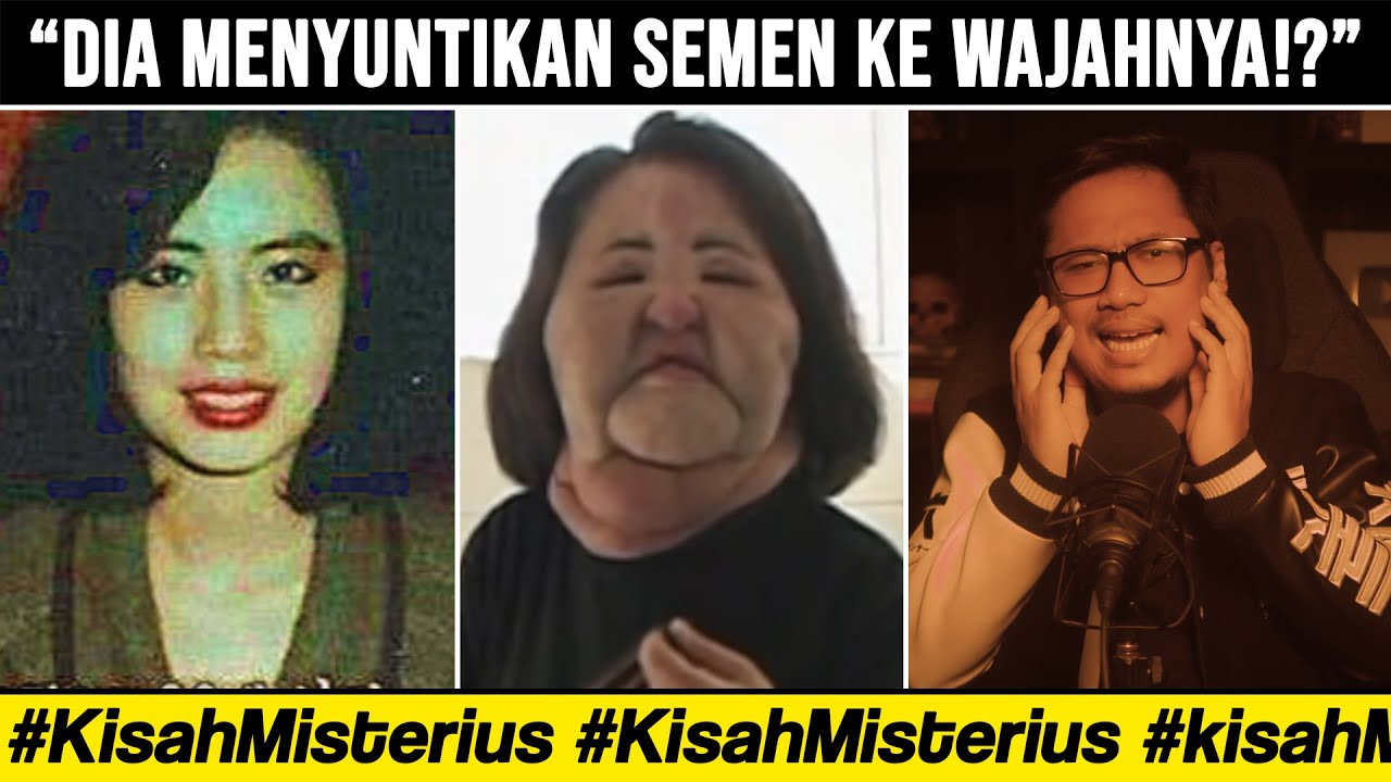 AKIBAT TEROBSESI SKINCARE DAN OPERASI PLASTIK | Han Hye Kyung