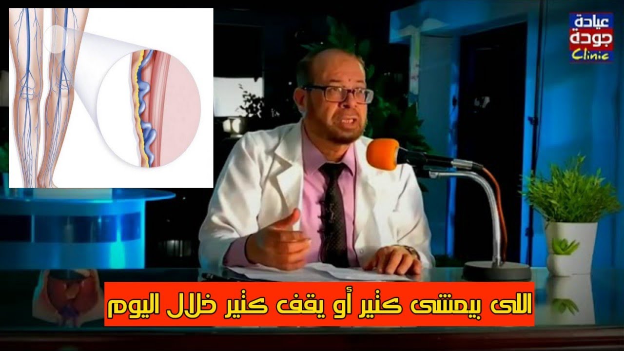 علاج دوالى الساقين وقبل ما تنام اعمل كدا | دكتور جودة محمد عواد
