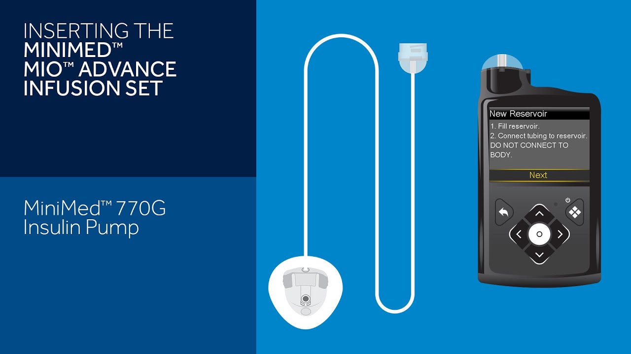 Установка инфузионного набора Mio Advance с системой MiniMed™ 770G
