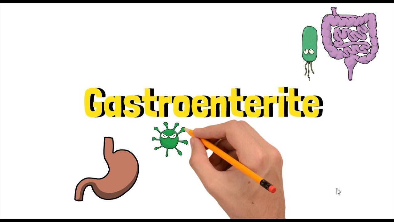 Gastroenterite | Ilustrando Sa&uacute;de
