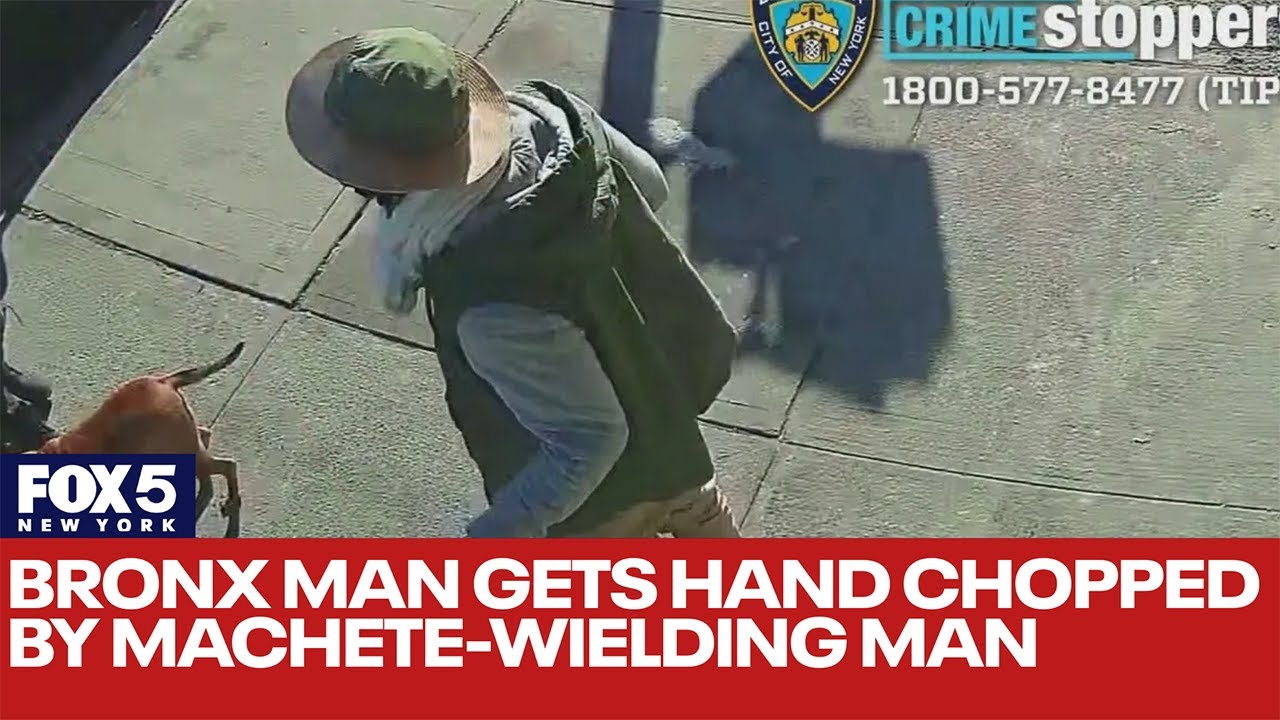 Bronx man gets hand chopped by machete-wielding man