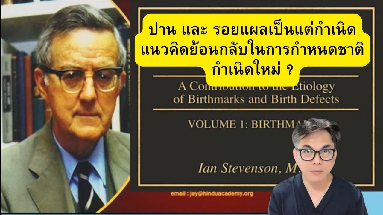 เรื่องลึกลับทางการแพทย์ : ปาน และ รอยแผลเป็นแต่กำเนิด กับ แนวคคิดย้อนกลับในการกลับมาเกิดใหม่ ?