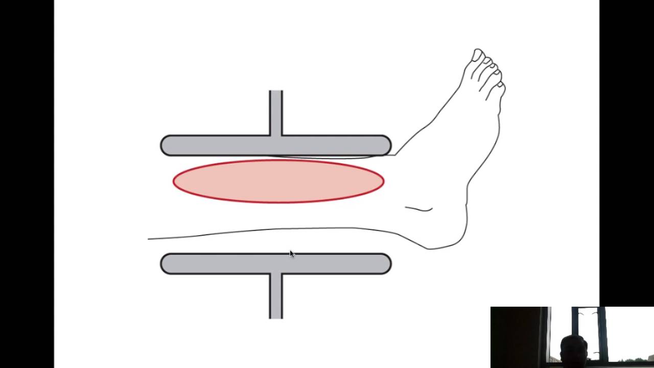 Shortwave Diathermy