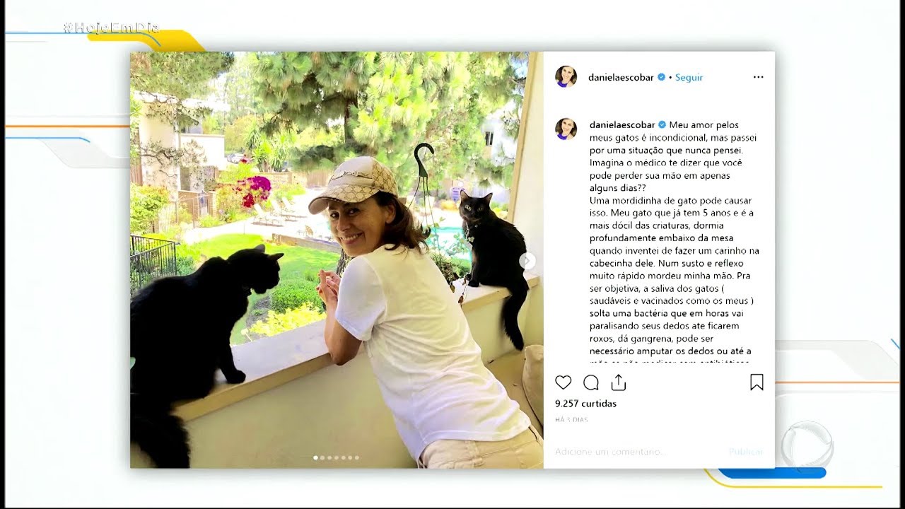 Atriz mordida por gato relata que quase perdeu a mão por infecção