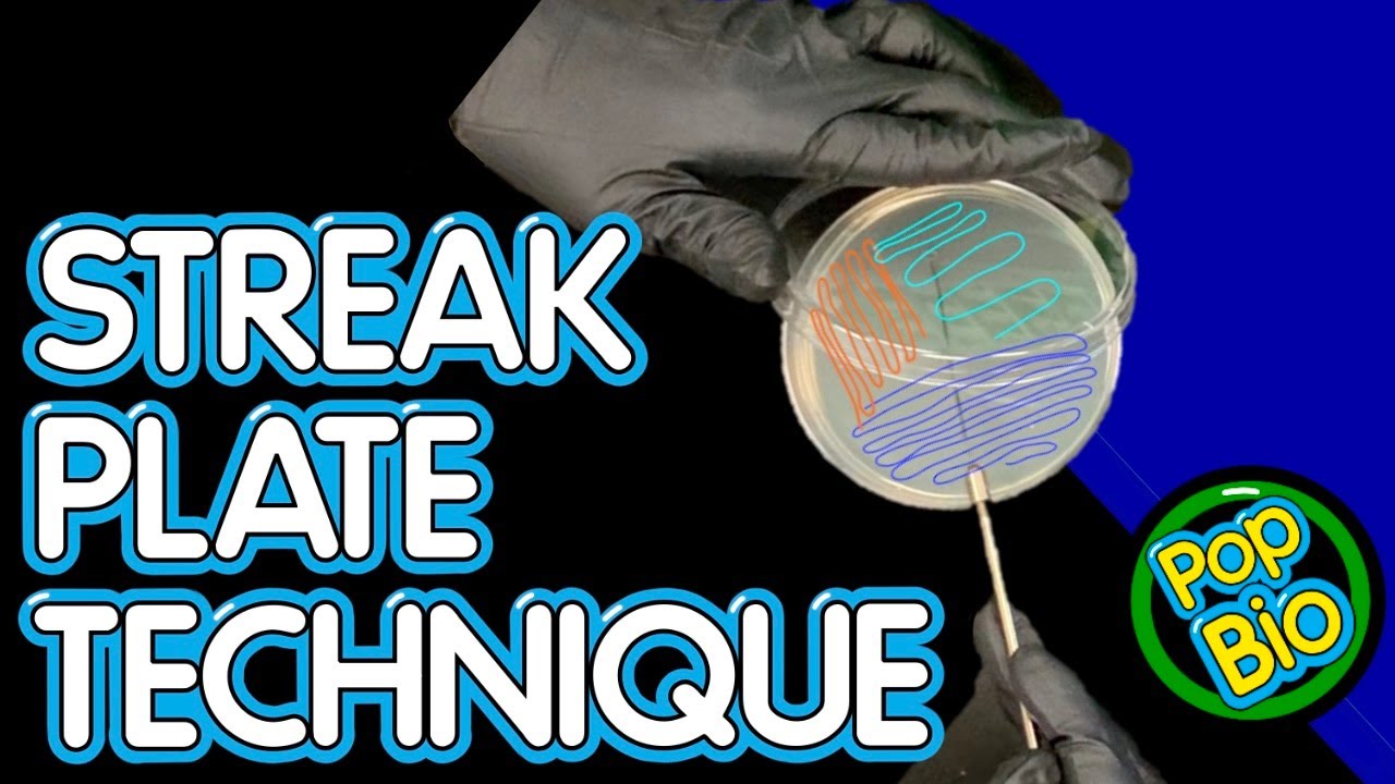 How to Perform Streak Plate Technique for the Isolation of Individual Colonies