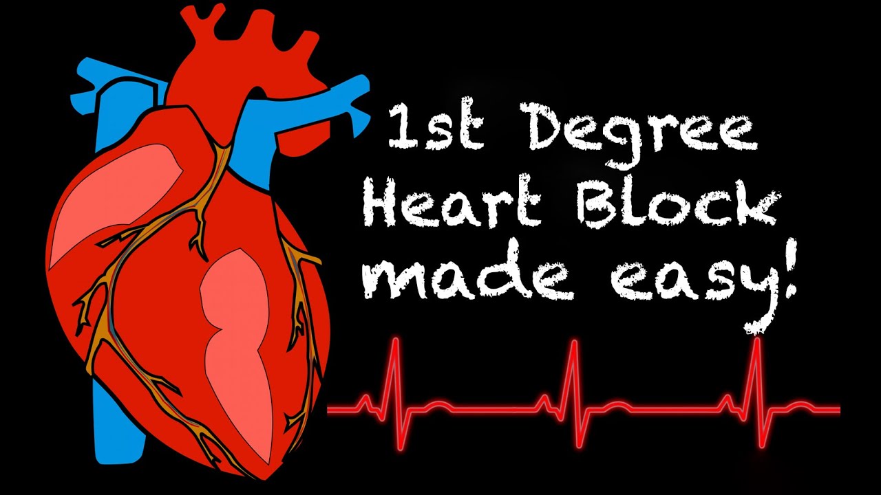 EMS Cardiology || Tachy Tuesday: 1st Degree Heart Block in EMS
