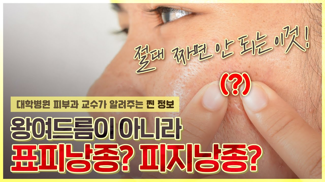 딱딱한 여드름? 뾰루지? 🤷‍♀️헷갈려서 짜면 큰일 나는 💀표피낭종💀 - [언니네피부과]