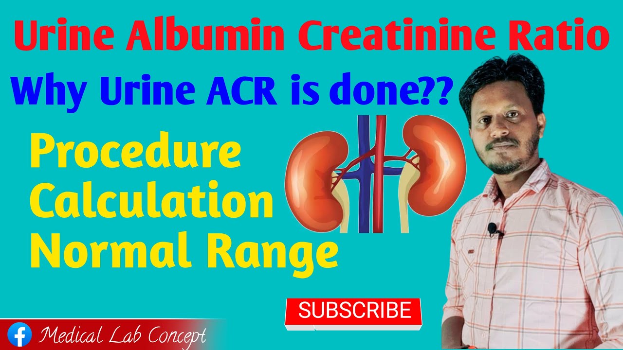 Urine ACR| Principle & Procedure with Calculation @Labology