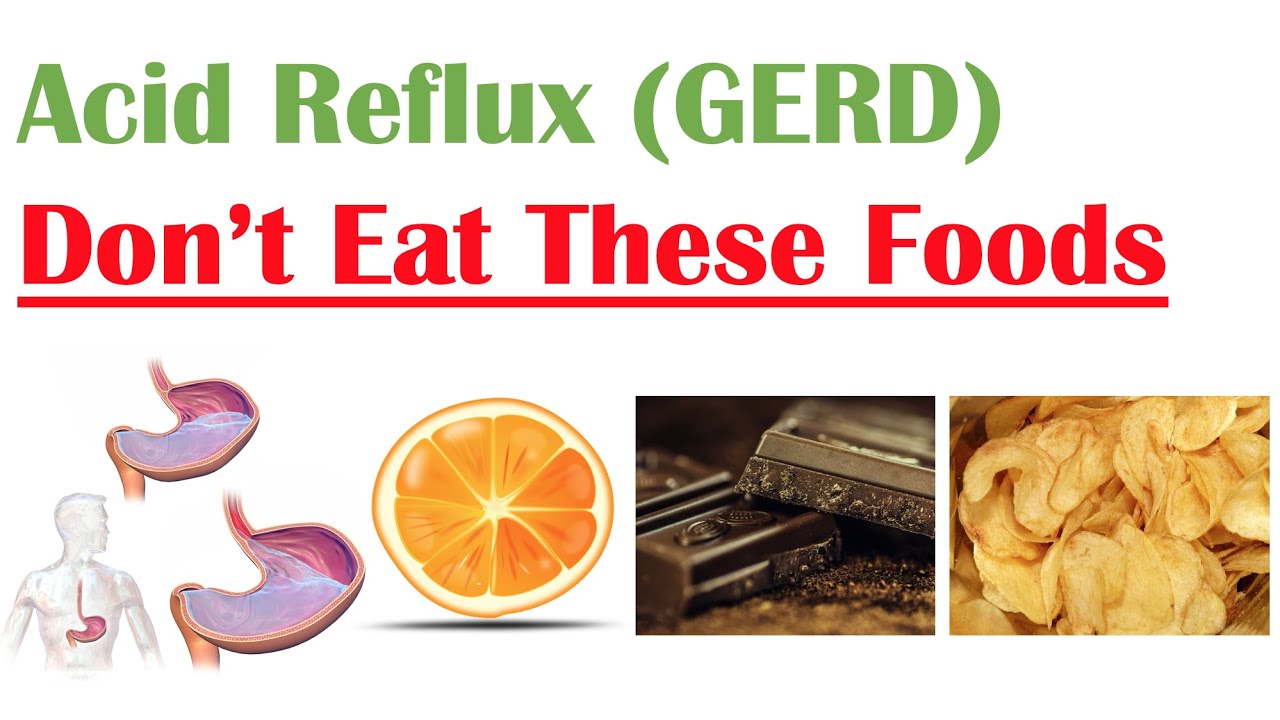 Worst Foods to Eat with Acid Reflux (GERD, Gastroesophageal Reflux Disease) | How to Reduce Symptoms