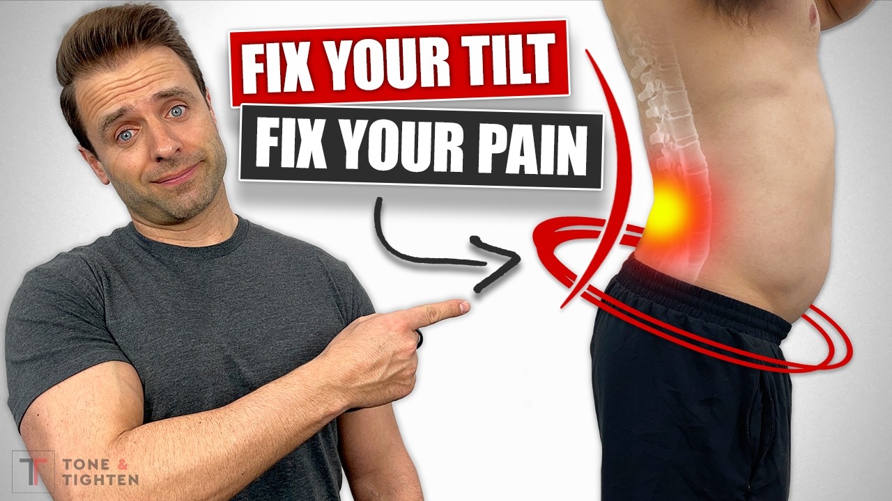 Fix Lower Back Pain Caused By Anterior Pelvic Tilt Posture [PERMANENTLY]