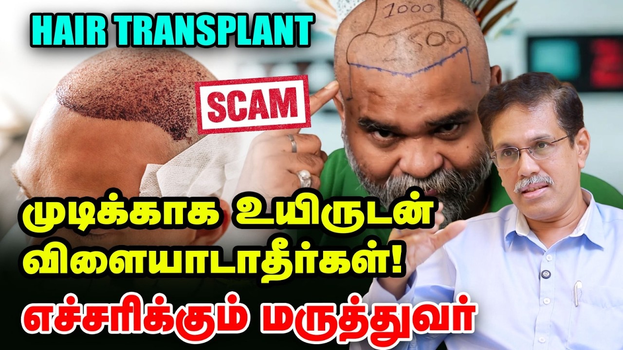 Hair Transplant Scam: முடிக்காக உயிரை பணையம் வைக்காதீங்க! - Dr Sivakumar shocking interview