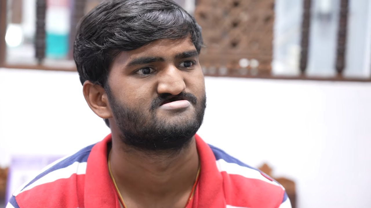 Young Man looses his entire upper Jaw to Cancer