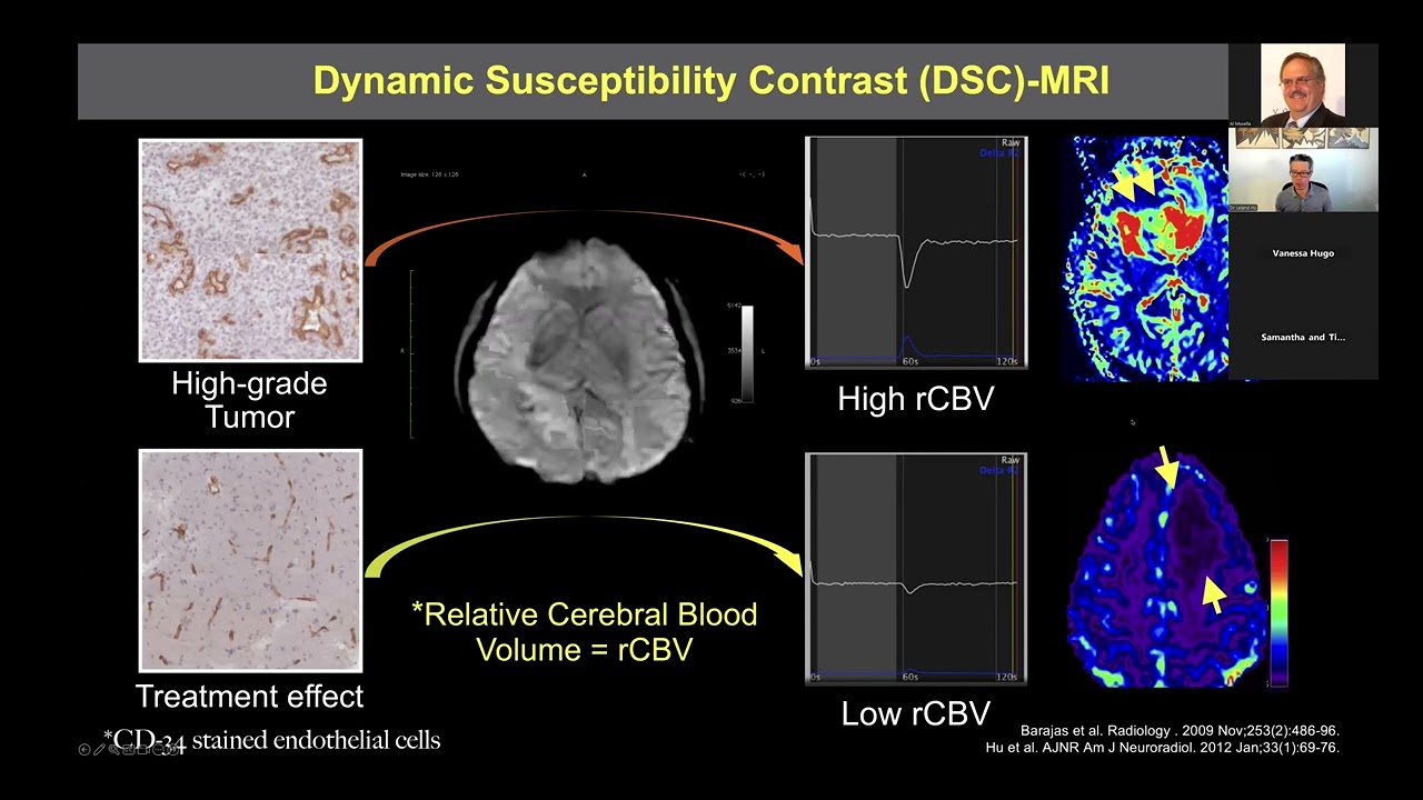 Fractional Tumor Burden Mapping