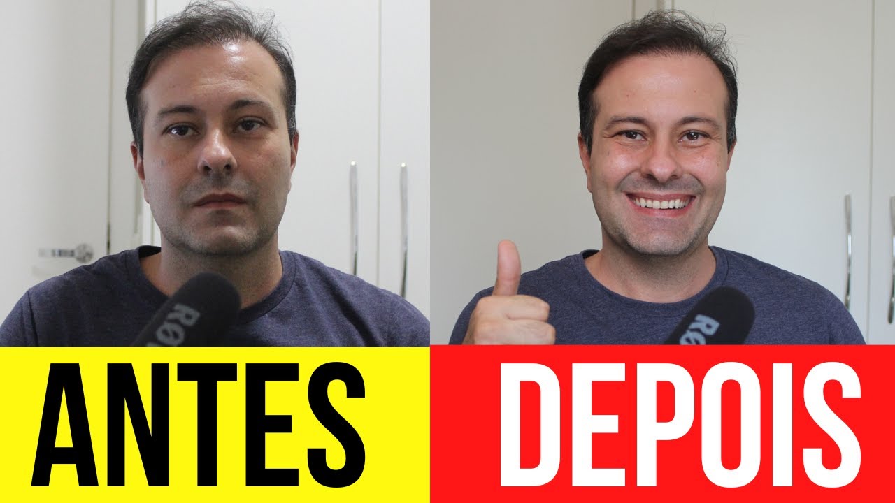 Como Melhorar a Qualidade da Câmera do celular
