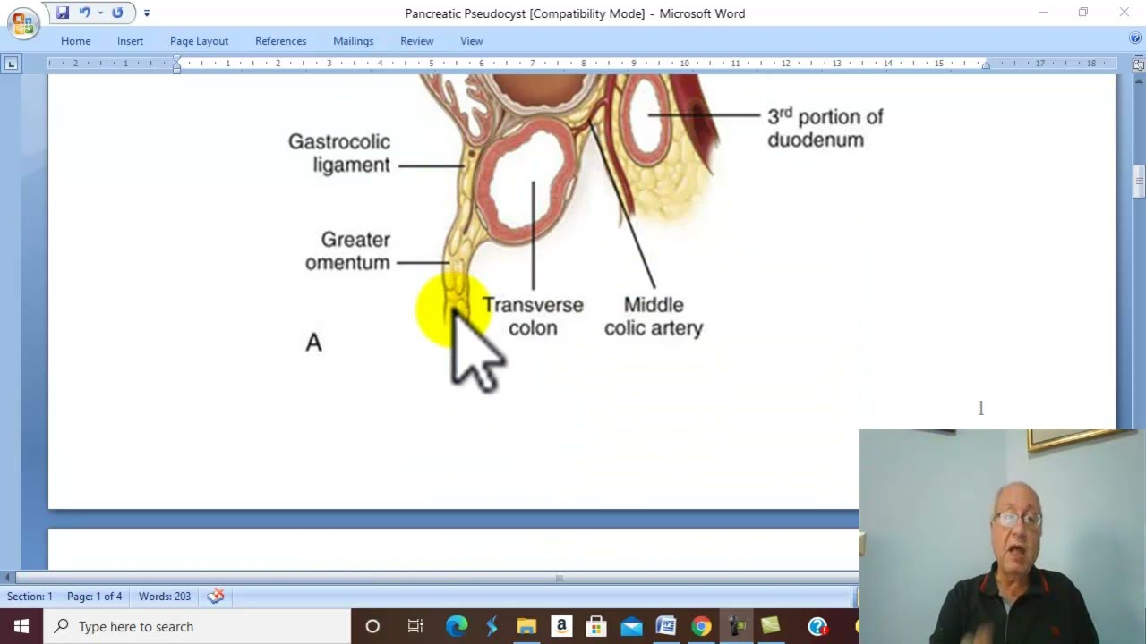 Pancreatic Disorders in Arabic 5 ( Pancreatic Pseudocyst ) , by Dr. Wahdan